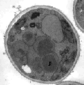 Electron micrograph of Pichia pastoris